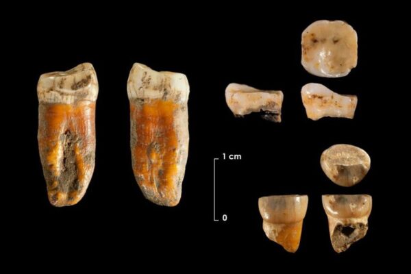 Dientes de hace 4,000 años revelan evolución de la dieta humana